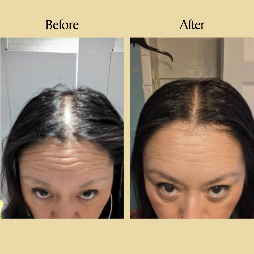 Veganie Natural Hair Growth Huile